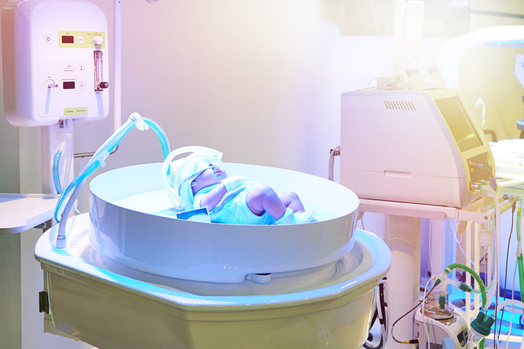 cooling baby brain image