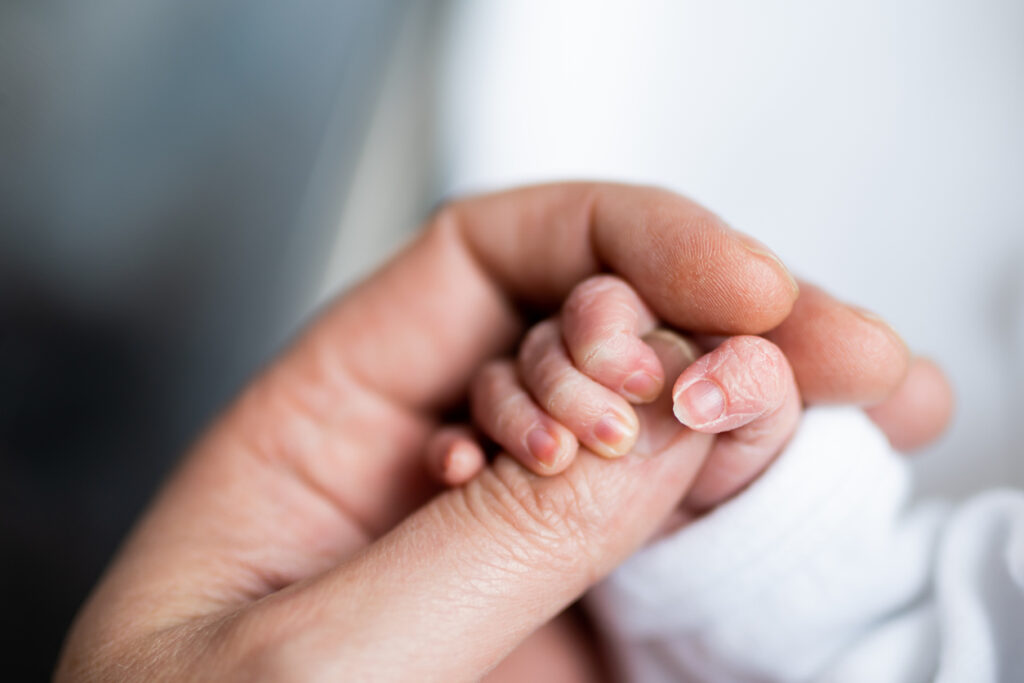 Neonatal hypoglycaemia