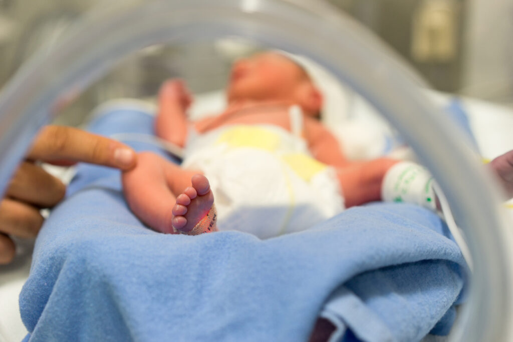 Hypoxic baby