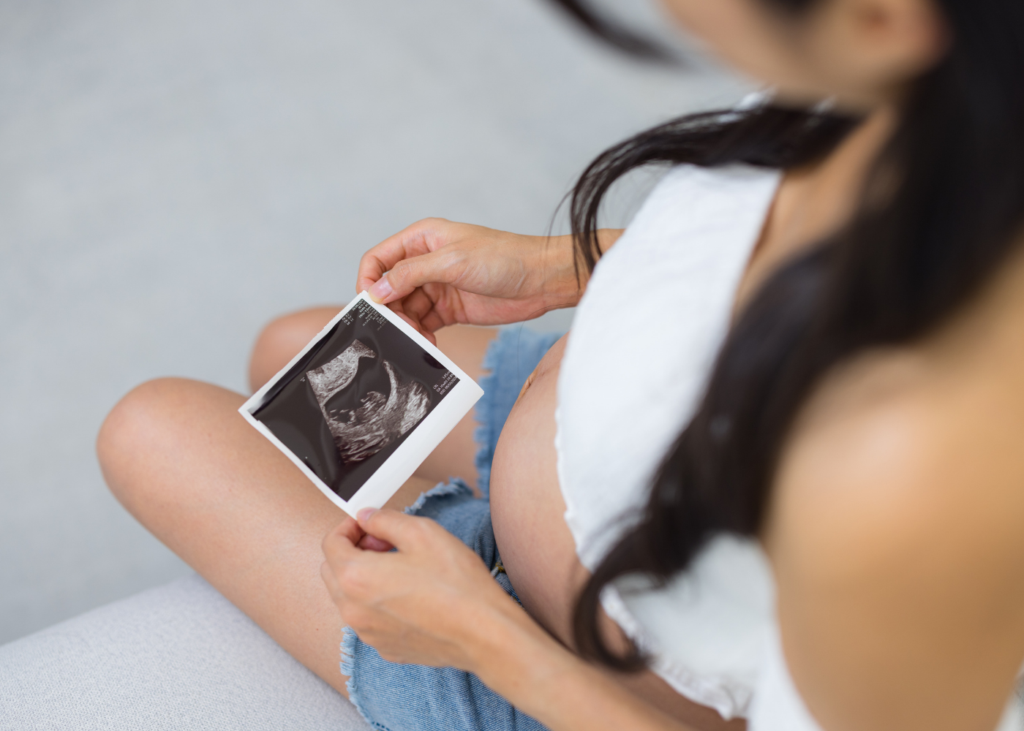 image of pregnant woman looking at her scan